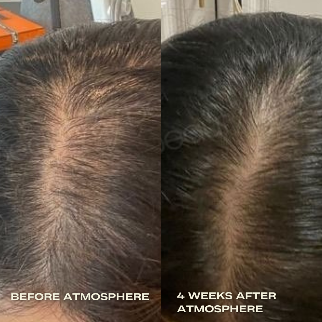 Luna Nectar - Atmosphere Multi-Peptide Hair Density & Scalp Serum ...